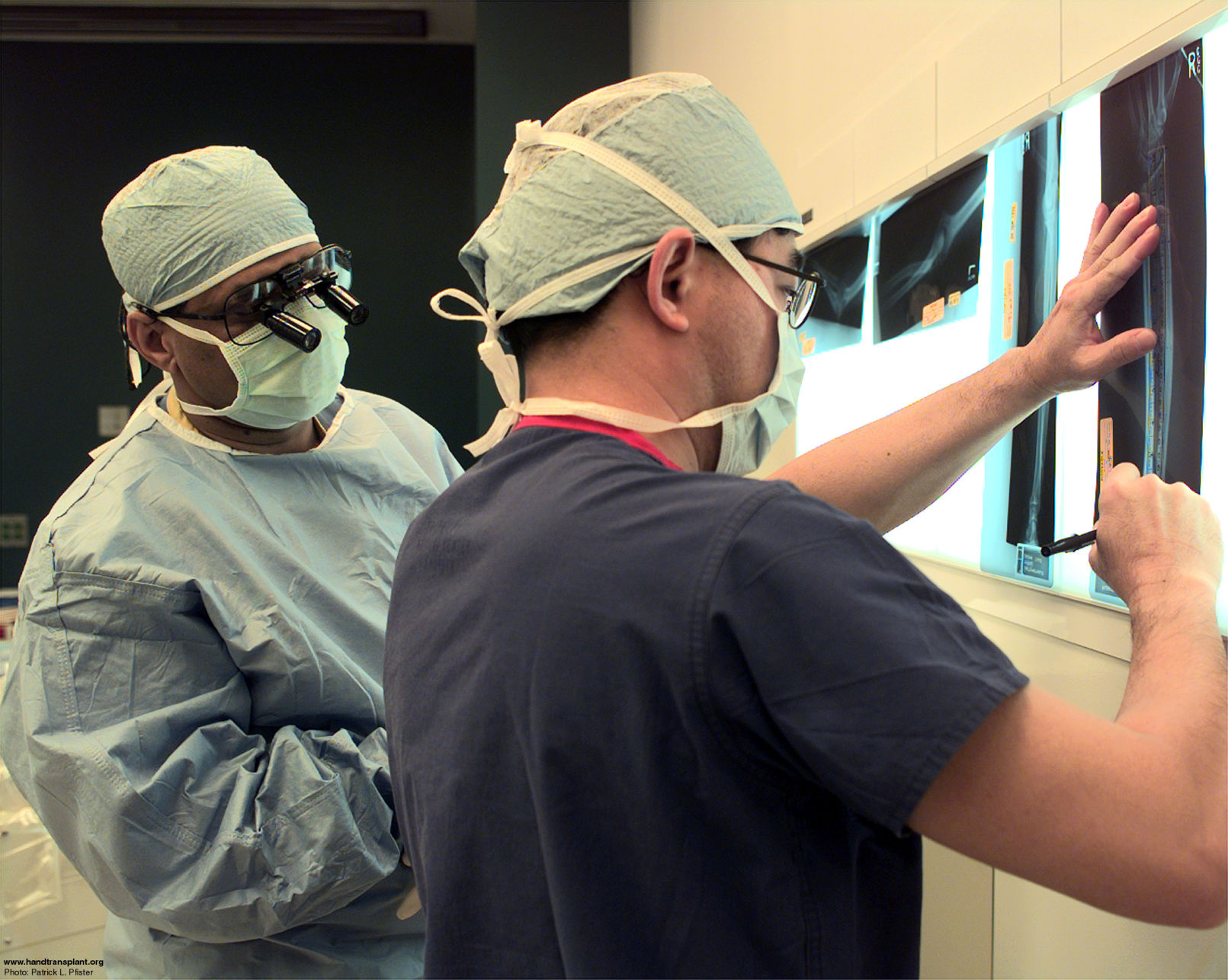 IMAGES | Hand transplant recipient Matthew Scott's progress since 1999